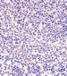 Mouse Nkx2-5 Antibody (Center)