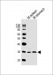 Mouse Nkx2-5 Antibody (Center)