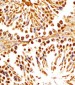 (Mouse) Dpf2 Antibody (N-term)