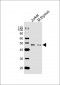 (Mouse) Dpf2 Antibody (N-term)