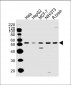 PPP2R2A Antibody (N-term)