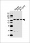 DPYSL5 Antibody (C-term)