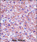 MBL2 Antibody (C-term)