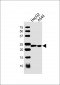 MBL2 Antibody (C-term)