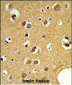 SNRPC Antibody (C-term)