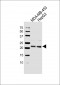 ATP5H Antibody (Center)