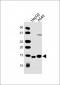 COX5B Antibody (Center)