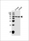 Glycerol kinase (GPK2) Antibody (C-term)
