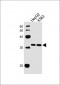 PYCR1 Antibody (C-term)