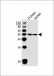 CHN1 Antibody (N-term)
