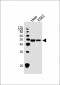 P2RX5 Antibody (C-term)
