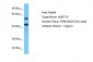 NUDT19 Antibody - C-terminal region