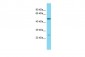 DSCC1 Antibody - middle region