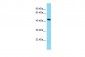 KIAA0141 Antibody - N-terminal region