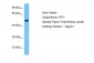 IFIT1 Antibody - C-terminal region