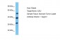 ILEU Antibody - middle region