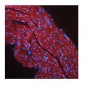 IGF1R antibody - middle region