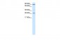 BCL2 antibody - N-terminal region