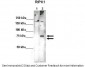 RIPK1 antibody - middle region