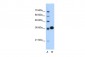 CDK6 antibody - C-terminal region