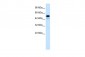 CDK8 antibody - C-terminal region