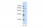 MDM4 antibody - N-terminal region