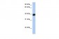 CXCR6 antibody - N-terminal region