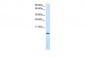 CXCL12 antibody - middle region