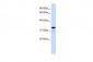 NFKBIA antibody - middle region