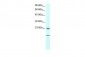 HSPB1 antibody - C-terminal region