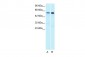 HTR1A antibody - N-terminal region