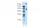 HTR7 antibody - N-terminal region