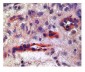 KDR antibody - N-terminal region