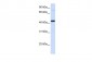 FOS antibody - middle region