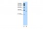 ATF5 antibody - N-terminal region