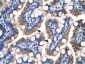 ATF5 antibody - N-terminal region