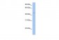 SOX8 antibody - C-terminal region