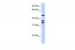 ETV6 antibody - N-terminal region