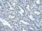 NR2F2 antibody - N-terminal region