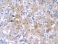 LHX1 antibody - C-terminal region