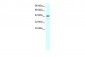 LHX1 antibody - C-terminal region