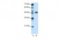 TFAP2A antibody - C-terminal region