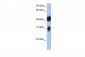 OTX1 antibody - C-terminal region