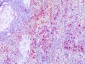 CX3CR1 Antibody (Extracellular Domain)