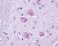 CHRM4 / M4 Antibody (Cytoplasmic Domain)