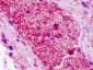 F2RL2 / PAR3 Antibody (Internal)