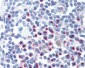 CCR4 Antibody (N-Terminus)