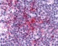 CCR6 Antibody (Cytoplasmic Domain)
