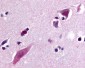 C5AR2 / GPR77 / C5L2 Antibody (N-Terminus)