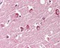 GPR119 Antibody (Cytoplasmic Domain)